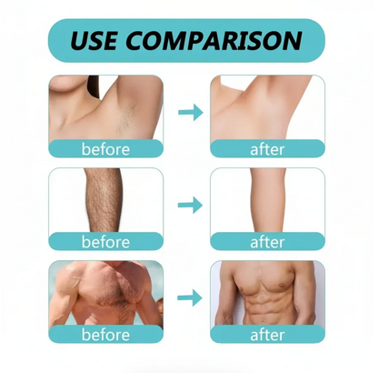 Ecrin Hair Removal Foaming Spray